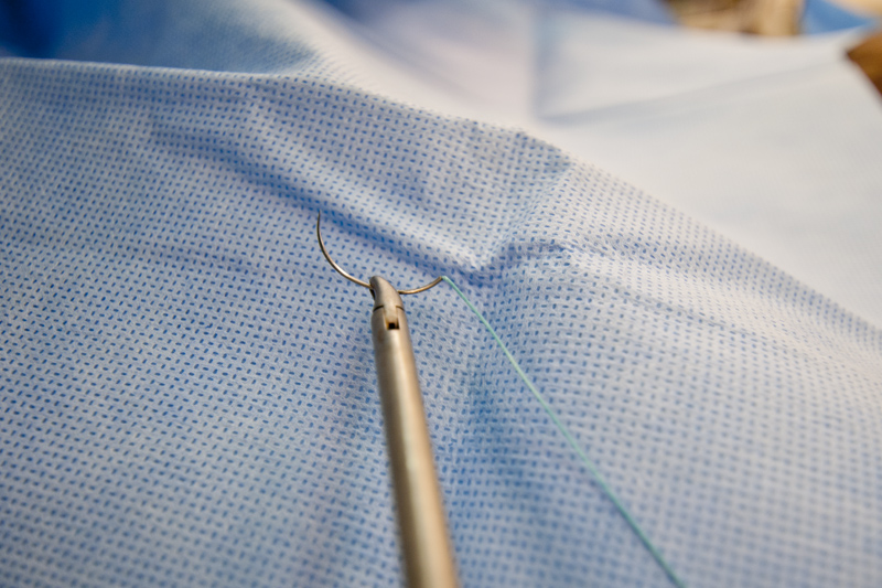 The suture for laparoscopic suturing has a very particular design. In general, the tip of the needle is called the needle point. The needle itself is known as the body. The swage is the back part of the needle where the suture is attached. The diameter, or the distance between the needle point and the swage is known as the chord length. 