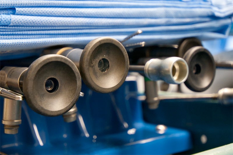 A series of scopes are seen lined up on an advanced laparoscopic surgical tray. The scopes themselves are of different diameter with different tips at the ends. Angled tips are sometimes optimal for looking around corners or at the undersurface of the abdominal wall. Larger scopes allow more light and therefore better image quality and visualization.