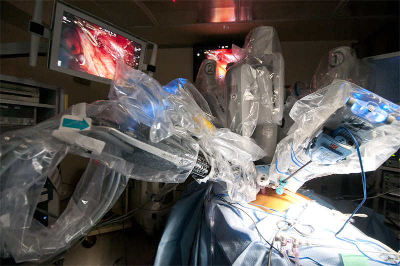 The robot, with its articulating instruments, is an optimal tool for operating in the tight spaces of the chest cavity. A robotic thymectomy requires dissecting the gland around the lung, off of the heart, around some very important nerves, and up into the neck.