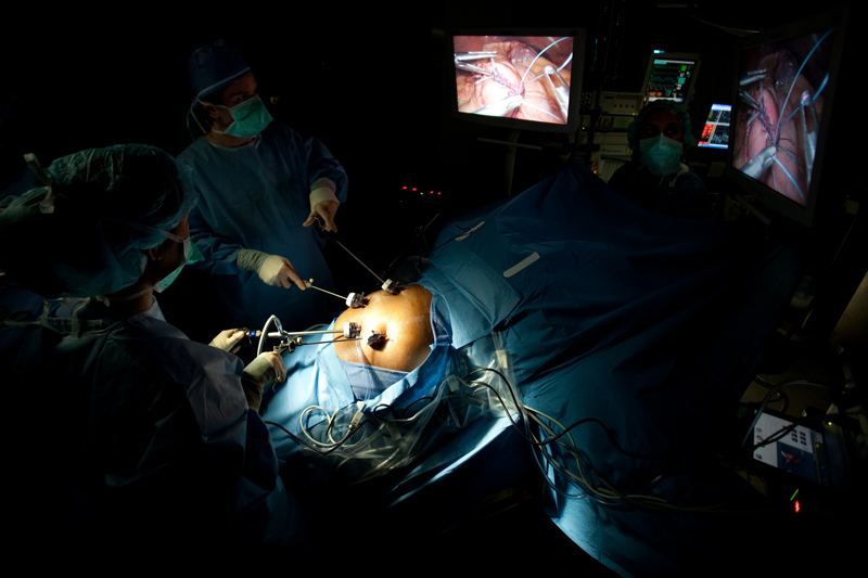 Dr. Belsley en el quirófano realizando una cirugía de bypass gástrico