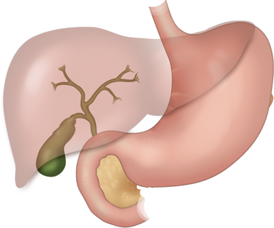 Illustration of the gallbladder and relationship to pancreas and bile ducts